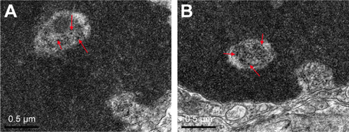 Figure S2 TEM evaluation of placental cell ultrastructure in pregnant mice caused by an intragastric administration with 10 mg/kg/day TiO2 NPs for 13 consecutive days. (A, B) Arrows indicate that TiO2 NPs aggregated in the nucleus of placental cells.Abbreviations: TiO2 NPs, titanium dioxide nanoparticles; TEM, transmission electron microscope.