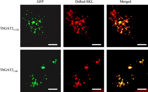 Figure 7.  Intracellular localization of GAT2(1–126) and GAT2(1–90) in CHO cells. CHO cells transfected transiently with plasmids expressing the peroxisomal marker protein DsRed-SKL and GFP-GAT2(1–126) or GFP-GAT2(1–90) were examined for direct fluorescence 48 h after transfection. In both cases the peroxisomal localization was demonstrated by the perfect colocalization with DsRed-SKL. Bars, 10 µm.