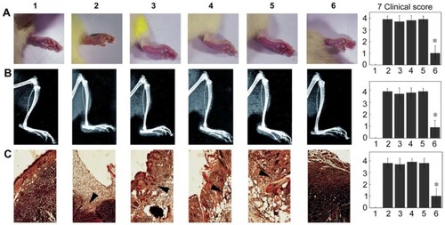 Figure 9 Therapeutic effects of ASO delivered by c-agarose gel on the development of AA. Row A are photographs of the inﬂamed feet of AA. Row B represents the X-ray examination of the inﬂamed feet. Row C shows the sections of inﬂamed feet tissue. All the results were taken on the 15th day after ASO administration and n=10, while, the clinical indexes are summarized in the 7th column. *P<0.05 v/s AA animals without the treatment of ASO. Reprinted with permission from Elsevier: Biomaterials, Spleen-specific suppression of TNF-α by cationic hydrogel-delivered antisense nucleotides for the prevention of arthritis in animal models, Dong L, Xia S, Chen H, Chen J, Zhang J, Copyright 2009.Citation181