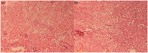 Figure 2. (a) Frank tubular necrosis, edema and increase of Bowman’s space (I/R group). (b) The large area of tubular necrosis (I/R group). H&E × 100.