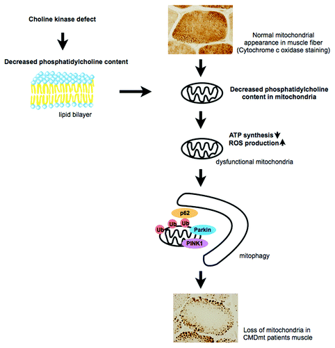 Figure 1. In normal muscle fiber, mitochondria distribute uniformly. Choline kinase defect causes a decreased phosphatidylcholine level in the mitochondrial membrane, leading to mitochondrial dysfunction. These mitochondria are eliminated by mitophagy, probably resulting in sparse mitochondria in muscle fiber.