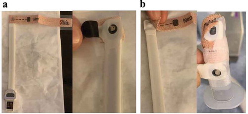 Figure 1. (a) Removing the adhesive cloth wrap of the sensor (b) Pulse oximeter sensor attached to oropharyngeal airway