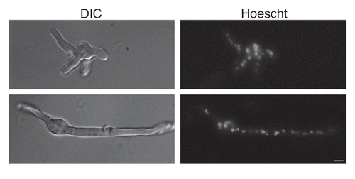 Figure 4 Accessory conidia undergo hyperpolarization during germination. Early germ tube formation and Hoechst nuclei staining was assessed for A. terreus accessory conidia. DIC and UV images were captured by microscopy at 100x, and are representative of 3 experiments. Scale bars denote 10 µm.