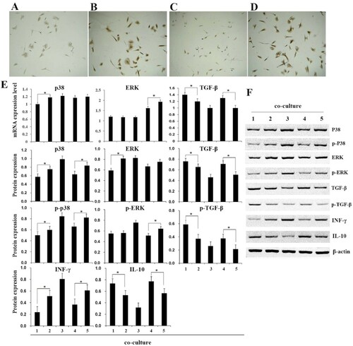 Figure 4. Detection of related gene and protein expression of immune responses. (A–D), vWF detection by immunohistochemistry, the four groups of cells were contact co-culture/TIPE2 (A), contact co-culture/null (B), non-contact co-culture/TIPE2 (C), and non-contact co-culture of/null (D). E, qRT-PCR and western blot detect the expression of p38, ERK, TGF-β, INF-γ, and IL-10. F, Western blot detect the protein expression. (1) contact co-culture/TIPE2; (2) contact co-culture/null; (3) cardiomyocytes; (4) non-contact co-culture/TIPE2; (5) non-contact co-culture of/null. ‘*’ indicate p  <  0.05.