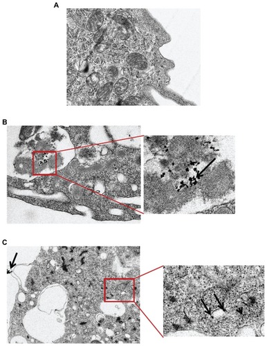 Figure 3 Transmission electron microscopic analysis of CeO2 nanoparticle-treated human monocytes. Cells were treated with (A) media, (B) 0.5 μg/mL, and (C) 1 μg/mL CeO2 nanoparticles for 24 hours and ultrastructural changes were observed.Note: Arrows point to the particle aggregates.