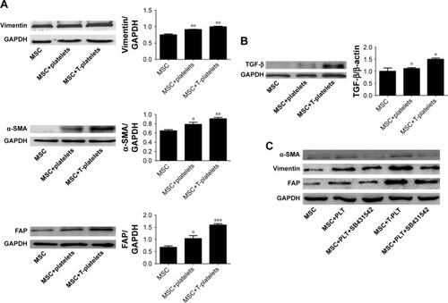 Figure 2 Platelets induce BM-MSCs transdifferentiation into CAF-like cells by secreting TGF-β.