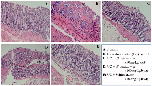 Figure 7. Histological colonic mucosal sections of normal rat: (A) normal mucosa with intact epithelial surface and acetic acid-induced colitis; (B) massive necrotic destruction of epithelium. (C and D) Pre-treatment with B. sensitivum (50 or 100 mg/kg b wt) and (E) sulfasalazine (100 mg/kg b wt) attenuated the extent and severity of cell damage.