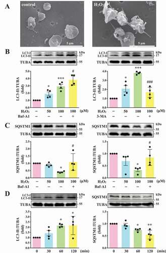 Figure 1. LC3-II and SQSTM1/p62 expression and autophagic flux in H2O2-activated human platelets. (A) Representative scanning electron microscopy (SEM) images of platelets treated with or without 100 μM H2O2 for 60 min. Scale bars: 5 μm. (B and C) Washed platelets (1.2 × 109/mL) treated with 50 and 100 μM H2O2 for 60 min in the presence or absence of Baf-A1 (200 nM) or 3-MA (3 mM). (D) Washed platelets treated with 100 μM H2O2 for the indicated time (0–120 min). LC3 and SQSTM1/p62 detected using specific antibodies through western blotting. Data (B-D) are presented as the means ± S.E.M. (n = 4). *P < 0.05, **P < 0.01, and ***P < 0.001, compared with the control group. #P < 0.05 and ###P < 0.001 with the H2O2-treated group