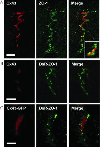 Figure 2 Full-length ZO-1 targets to edge domains of gap junctions composed of either Cx43 or Cx43-GFP. (A) Immunofluorescence of Cx43 (red) and endogenous ZO-1 (green) in HeLa Cx43 cells. HeLa Cx43 (B) and HeLa Cx43-GFP (C) cells transiently expressing DsR-ZO-1, with Cx43 (red) detected by immunofluorescence (B) or GFP fluorescence (C), and ZO-1 (green) by DsRed fluorescence (B, C). Note that both endogenous ZO-1 (A, inset) and DsR-ZO-1 (B) display stretches of continuous overlap with the edges of Cx43 plaques, whereas DsR-ZO-1 associated with Cx43-GFP GJs manifests as punctate rather than diffuse accumulations along plaque edges that exhibit minimal overlap with Cx43. All images are maximum projections of z-series acquired by laser scanning (A) or spinning disk (B, C) confocal microscopy. Scale bars, 5 μ m.