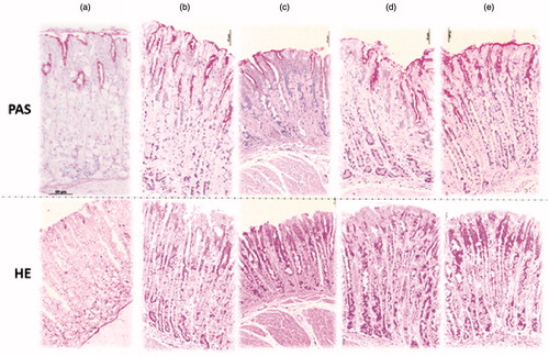 Figure 6. Effect of resin Virola oleifera on the histological evaluation of ulcer model induced by indomethacin. Sections stained with periodic acid-Schiff (PAS) and hematoxylin and eosin (HE) (a–e). Sections made in gastric mucosa in negative control group (a). Microscopic appearance of indomethacin-induced lesions in the gastric mucosa pretreated with vehicle (b). Microscopic appearance of indomethacin-induced lesions in the gastric mucosa pretreated with lansoprazole 3 mg/kg (c). Microscopic appearance of lesions pretreated with 10 mg/kg (d), and 100 mg/kg (E) of V. oleifera. Scale =50 μm (upper and lower micrograph, respectively). n = 5.