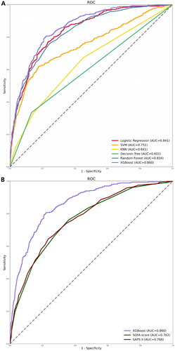 Figure 2. ROC curves for the ML models and the traditional severity of illness scores to predict in-hospital mortality. (A) ROC curves for the six ML models used to predict in-hospital mortality; (B) ROC curves for the traditional severity of disease scores used to predict in-hospital mortality. ROC: receiver operating characteristic; SVM: support vector machine; KNN; k-nearest neighbors; AUC: area under the curve; SOFA: sequential organ failure assessment; SAPS II: simplified acute physiology score II.