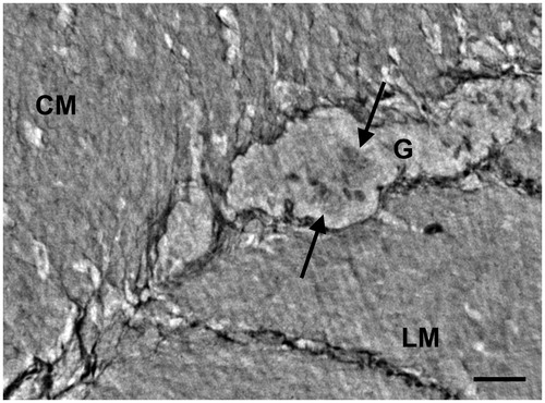 Figure 6. Ileum. High-resolution scan. The myenteric ganglion is little with a few neurons (arrows) showing intracellular dense granules (upper neuron) or vacuoles (lower neuron). G: ganglion; CM: circular muscle; LM: longitudinal muscle. Bar: 25 μm.