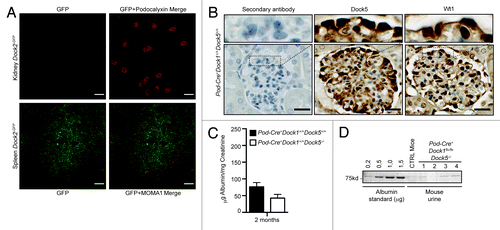 Figure 5.Dock5 is not essential to glomerular function. (A) Dock2 is not expressed in the kidney. Dock2-GFP expression is absent in the kidney (top), but can be detected in the spleen (bottom) (Scale bar: 100 μm, 20x). (B) IHC analyses showing the expression of Dock5 and Wt1 in the podocytes of Pod-Cre+Dock1+/+Dock5+/+ mice (Scale bar: 25 μm, 100x). (C) Normal renal function in the absence of Dock5 expression in mice. Quantification of the average albumin-to-creatinine ratio in the urine of Pod-Cre+Dock1+/+Dock5+/+ and Pod-Cre+Dock1+/+Dock5−/− 2 mo old mice (n = 3). (D) Absence of proteinuria in the urine of P21 Pod-Cre-Dock1flx/flxDock5+/+ and Pod-Cre+Dock1flx/flxDock5−/− mice. Coomassie stained protein gel showing BSA standards (left) and the albumin content from the urine of a control mouse and 4 Pod-Cre+Dock1flx/flxDock5−/− mutant mice.