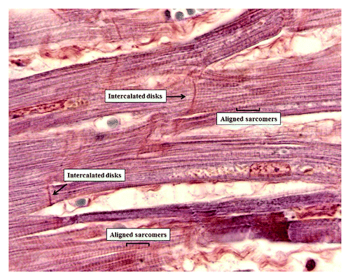 Figure 6. Heart microanatomy showing the intercalated disks (Phosphotungstic acid hematoxylin staining 1,200× oil).