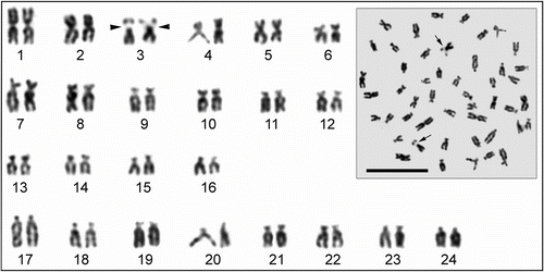 Figure 1 Metaphase spread and karyotype of Tinca tinca. Arrows indicate the secondary constrictions (scale bar = 10 μm).