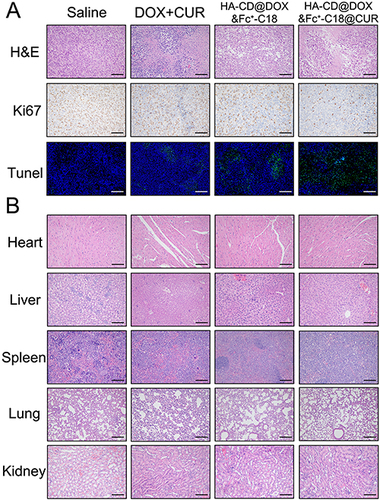 Figure 8 Histopathologic examination of tumor tissues and major organs: (A) The H&E, Ki 67 and Tunel staining of tumor tissue after treatment with saline, DOX+CUR, HA-CD@DOX & Fc+-C18 and HA-CD@DOX & Fc+-C18@CUR, respectively. (B) The H&E staining of major organs after treatment with saline, DOX+CUR, HA-CD@DOX & Fc+-C18 and HA-CD@DOX & Fc+-C18@CUR, respectively.