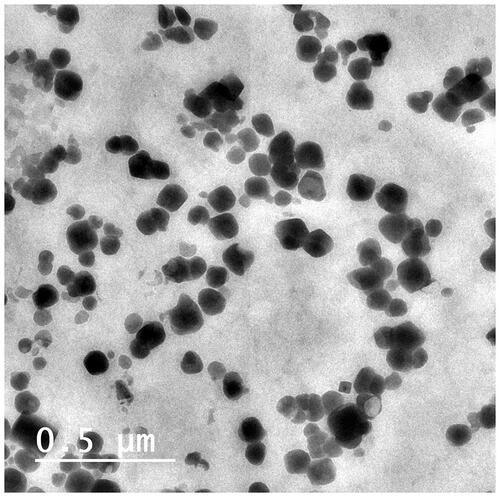 Figure 1 Transmission electron micrography of the GMC LPs when stained with uranyl acetate 10%.