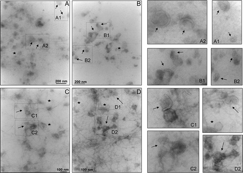 Figure 1. Transmission electron micrograph of vesicles in the 200,000 g supernatant. Ten μg of protein was adsorbed on the grid and negative stained by uranyl acetate. Images were taken at ×40,000 (A and B) and ×50,000 (C and D) magnifications. This magnification was used as in published literature to identify exosomes and exosome-like particles based on their diameter (20–100 nm): exosomes (arrows) and exosome-like vesicles (stars). Figures on the right are enlargements of area of the same field to better visualise the morphology.