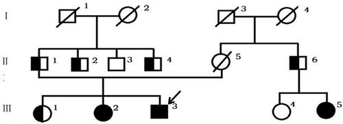 Figure 1 Genealogical tree of Sardinian family: full black circle or square = Val282Leu homozygous patients; black and white circle or square = Val282Leu heterozygous subjects; full white circle or square = wild-type subjects.