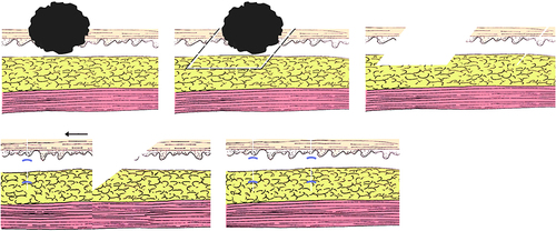 Figure 4 Schematic diagram of kite flap I.