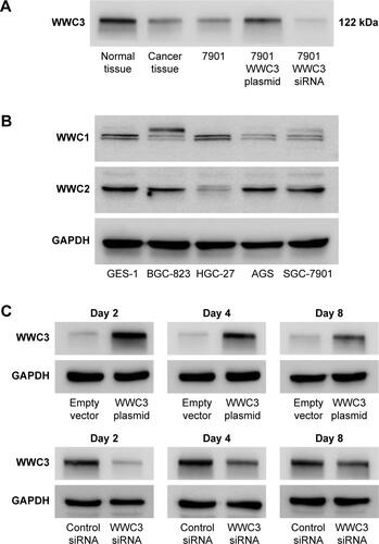 Figure S1 Validation of antibody and transfection efficiency.Notes: (A) The specificity of the antibody was validated by using gastric cancer tissue, corresponding normal tissue, and cell lines with WWC3 overexpression and siRNA depletion. Western blot was used to examine WWC3 with this antibody. The Western blot bands of cells were strong when WWC3 was overexpressed and were weak when depleted. Gastric cancer tissues and normal tissues showed similar single bands at the same molecular weight. (B) Expression of WWC1 and WWC2 proteins in gastric cancer cell lines and GES-1 cell line. (C) The knockdown and overexpression efficiency were checked at different time points (at 2, 4, and 8 days after transfection) using Western blot. The transfection of plasmid significant upregulated WWC3 protein at day 8. The knockdown efficiency was most significant at day 2 and could still be observed at day 8.Abbreviation: siRNA, small interfering RNA.