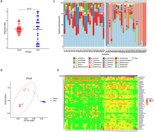 Figure 3. Comparisons of microbiome in prostate tissue and catheterized urine. Shannon index (a) shows alpha-diversity (p = 0.75; Wilcoxon rank sum test) and PCoA based on the Bray-Curtis distance (b) shows beta-diversity. (c) the relative abundances of bacterial genera in various samples shown in bar plots. (d) Heatmap of genus-level abundance in prostate tissue and catheterized urine, based on the Euclidean distance and complete-linkage hierarchical cluster.