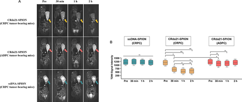 Figure 7 In vivo subcutaneous CRPC and ADPC model MR imaging at pre-injection, and at 30 minutes, 1 hour and 2 hours post-injection of the probes (n = 32). (A) Images of CRPC tumor-bearing mice, which showed significant T2WI signal intensity decrease of tumors (yellow arrows) after injection of CRda21-SPION. Images of ADPC tumor-bearing mice showed the T2WI signal intensity in the tumor site (red arrows) slightly decreased after the injection of CRda21-SPION. CRPC tumor-bearing mice injected with ssDNA-SPION was used as negative control and there were no significant T2WI signal intensity changes in the tumor site (green arrows). (B) Quantitative signal intensity measurement of T2WI for the tumors at different time points. The data were presented as median with interquartile range (IQR). *P < 0.05, **P < 0.01.