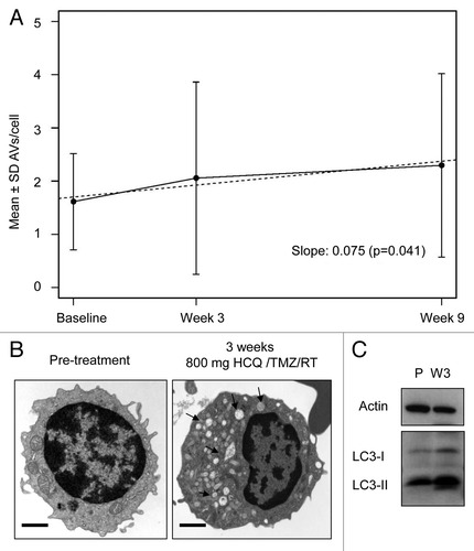 Figure 1. Pharmacodynamic evidence of autophagy inhibition in patients treated with temozolomide (TMZ), radiation (RT), and hydroxychloroquine (HCQ). (A) Mixed-effects model of mean ± SD autophagic vacuoles (AVs)/cell. Dotted line: regression line. (B) Representative electron micrographs from a patient treated with chemoradiation and HCQ 800 mg/d for 3 wk. Arrows, AV; scale bar: 2 µm. (C) Immunoblotting against LC3 in the lysates of PBMC obtained from the same patient in (B). P, pretreatment; W3, 3 wk of treatment.