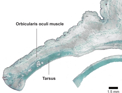 Figure 2 The preseptal orbicularis oculi muscle of the upper eyelid continues straightly to the pretarsal orbicularis oculi muscle. Bar = 1.5 mm.