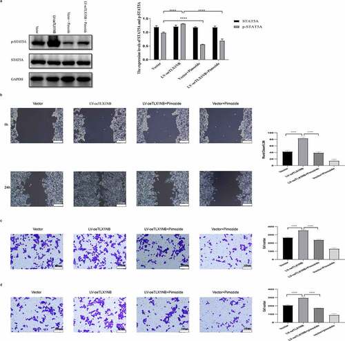 Figure 7. The inhibition of STAT5A phosphorylation reversed TLX1NB overexpression-associated increases in HCT116 cell migratory and invasive activity. Notes: TLX1NB-overexpressing HCT116 cells and their controls were treated in the absence or presence of pimozide (10 μM) for 24 hours. (a) The STAT5A and p-STAT5A protein expression levels in TLX1NB-overexpressed HCT116 cells and their negative controls with or without pimozide treatment. (b) Wound healing assays for TLX1NB-overexpressed HCT116 cells and their negative controls with or without pimozide treatment. (c) Transwell migration assays for TLX1NB-overexpressed HCT116 cells and their negative controls with or without pimozide treatment. (d) Transwell invasion assays for TLX1NB-overexpressed HCT116 cells and their negative controls with or without pimozide treatment. ****P < 0.0001.