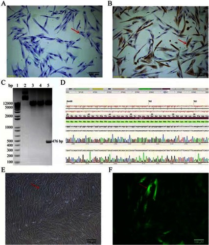 Figure 1 Identification of human uterine leiomyoma cells and infection with IGF-1 lentivirus vectors. (A) Negative control of α-actin in human leiomyoma cells (100) (B) α-Actin positive staining (100) (C) Double digestion of pLVX-IRES-ZsGreen1-IGF-1 (D) The sequencing of pLVX-IRES-ZsGreen1-IGF-1 (E) The human uterine leiomyoma cells under bright-field microscope (F) The GFP transfection efficiency of IGF-1 lentivirus vectors. Red arrows show the details.