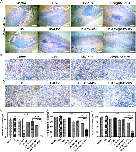 Figure 3 Effect of ultrasound-mediated LEV@CAT-NPs on hypoxia within tuberculous granuloma tissues. (A) Images of pimonidazole staining for hypoxia in granulomatous tissue conducted by different treatments. (B) Images of HIF-1α immunohistochemical staining in the granulomatous tissue conducted by different treatments. Scale bars are 100 μm. (C) Image J quantified the area fraction of hypoxia (brown) within the granulomatous tissue, that is, the brown area of each granuloma area. (D) The serum levels of HIF-1α in mice were determined by ELISA with different treatments. (E) Level of H2O2 within the granulomatous tissue after different treatments. The data represent the mean ± SD of three independent experiments. ***p < 0.001.