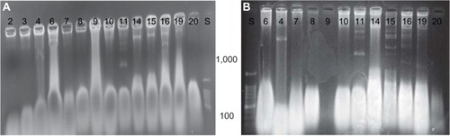 Figure 6 Plasmids comparative results.Notes: (A) Agarose 1%, 50 vol, 1 hour. (B) Agarose (1% agarose, 50 vol, 1.5 hours). Gel electrophoresis of plasmids extracted from various E. coli isolates. Numbers 1–11 water isolates, 14 and 21 clinical isolates. S-DNA ladder (100–1,000 bp).