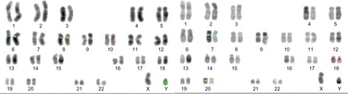 Figure 1 Examples of the metaphases fully karyotyped using reverse DAPI.