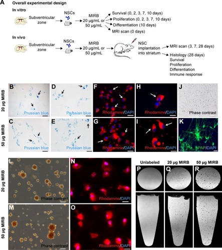 Figure 1 In vitro MIRB labeling and MRI imaging.Notes: (A) The overall experimental design of the study. Primary rat NSCs were treated with 20 and 50 μg/mL doses of MIRB, after which they were assessed directly after staining with Prussian blue (B–E) or under rhodamine fluorescence (F–I). As shown, both doses resulted in excellent incorporation of MIRB within the NSCs (arrows point to examples of labeled cells). Lower magnification images appear in (B), (C), (F), and (G), and higher magnification images appear in (D), (E), (H), and (I). These NSCs (J) had been obtained from newborn rats transgenically expressing hPAP, and therefore also robustly expressed hPAP in culture (K). The MIRB labeling (directly noted as brown staining under phase contrast), at both doses, was strongly maintained in the NSCs after several passages in culture (L and M, at passage 14) and after NSC differentiation for 10 days (N and O). When tubes containing single-cell suspensions of MIRB-labeled NSCs were scanned via 3D gradient-echo MRI, signal dropout from individual cells was evident in both 20 and 50 μg tubes, although not surprisingly, the signal intensity was greater with the 50 μg MIRB-labeled cells (P–R). Scale bars: 20 μm (B, C, F, and G), 10 μm (D, E, H, I, N, and O), 100 μm (J and K), and 50 μm (L and M).Abbreviations: MIRB, Molday ION Rhodamine B; MRI, magnetic resonance imaging; NSCs, neural stem cells; DAPI, 4′,6-diamidino-2-phenylindole.
