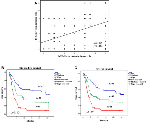 Figure 4 Correlation analysis between MDM2 and p53 expression in different cell populations and survival curves for OSCC patients according to their expression levels of MDM2 and p53 in tumour cells. (A) The expression levels of MDM2 and p53 in tumour cells were significantly positively correlated (p<0.001, R=0.414). (B and C) Disease-free survival and overall survival curves for patients according to the combined low, single high and combined high expression levels of MDM2 and p53 in tumour cells.