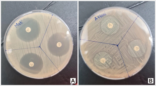 Figure 2 Antibiotic susceptibility testing with disc diffusion method. A sensitive antibiotic produce zones of inhibition (A), while a resistant antibiotic not produce zone of inhibition (B).