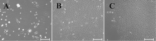 Figure 1. Morphology of primary rabbit bone marrow-derived MSCs. The cells were fibroblastic spindle-shaped at day 4 (A), day 8 (B), and 14 (C) in rbMSCs. Scale bars: 200 µm.