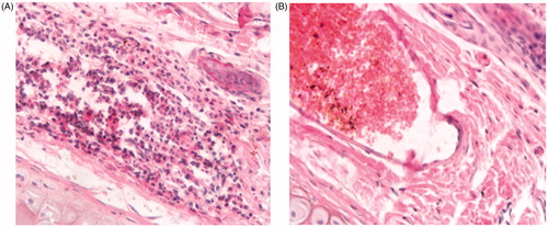 Figure 6. Histology images of rabbit irritation test. (A) 10-HCPT-HES injection conjugate group; (B) 10-HCPT-HES conjugate group.