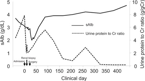 Figure 3 Serial changes in sAlb and urine protein before and after thoracoscopic left lower lobectomy.