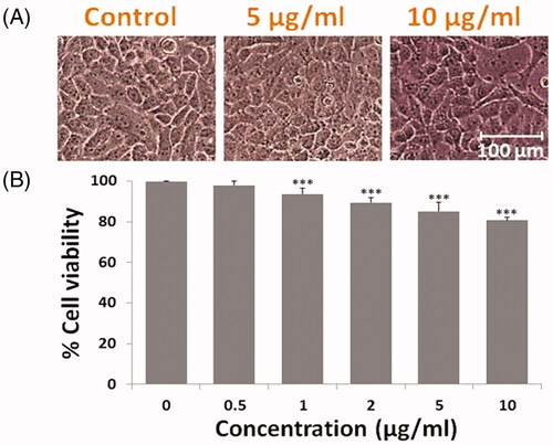 Figure 4. Photomicrograph showing effect to DOX SNEDDS against Chang liver cells of non-malignant human liver cells. (A) Showing morphological changes in Chang liver cells at higher doses i.e. 5 and 10 µg/ml concentrations of DOX SNEDDS. (B) Graph representing the % cell viability of Chang liver cells after treated with various concentrations (0.5, 1, 2, 5 and 10 µg/ml) of DOX SNEDDS.