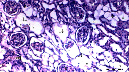 Figure 9 Representative light microscopy of kidney tissue from DIR group. Scale bar 50 µm, H&Ex100.