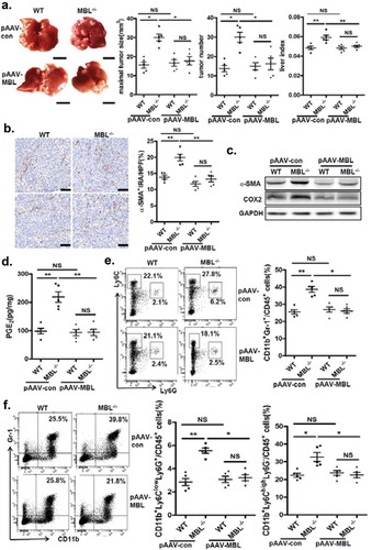 Figure 8. AAV-mediated restoration of hepatic MBL abrogated MBL deficiency-promoted tumor growth.The following parameters were measured in liver tumor tissues of WT and MBL–/– mice in the murine HCC model established as described in Figure 1. pAAV-con and pAAV-MBL vectors were administered 3 weeks before hepal-6 cell injection. (a) Liver tumor number, maximal tumor size and liver index were monitored. (b) The frequency of α-SMA+ activated HSCs in liver sections was evaluated by immunohistochemistry. (c) α-SMA and COX-2 protein expression and (d) PGE2 production in the liver were determined by immunoblotting and ELISA respectively. (e) MDSCs (Gr-1+CD11b+), (f) G-MDSCs (CD11b+Ly6ClowLy6G+) and M-MDSCs (CD11b+Ly6ChighLy6G−) frequency in liver tumor tissue. The percentages represent the cell frequency in CD45+ cells. Data are presented as means ± SEM (horizontal lines). NS, not significant. *, P < 0.05; **, P < 0.01. The data representative of at least three independent experiments with similar results are shown.