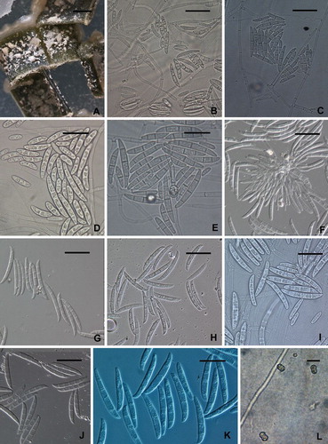 Fig. 5 Fusarium solani on carnation leaf agar. A. White to cream colored, slimy conidial masses formed by pionnote sporodochia on pieces of carnation leaf. B, C. Unbranched or sparsely branched conidiophores arising from the surface of the agar. D, E. 0-to-3 septate conidia produced from unbranched or sparsely branched conidiophores. F. Conidiophores from pionnote sporodochium producing up to 5-septate conidia. G–K. Conidia arising from pionnotes. L. Chlamydospores. A, C, E, J from FRC S-2362 (G.J.S. 09-1462); B, D, K, L from FRC S-2361 (G.J.S. 09-1461); F from NRRL 66307 (FRC S-2367, CBS 140077, G.J.S. 09-1469); G from FRC S-2363 (G.J.S. 09-1463); H, I from ex-epitype strain NRRL 66304 (FRC S-2364, CBS 140079, G.J.S. 09-1466). Scale bars: A = 1 mm; B–E, I, K = 20 μm; F–H, J = 30 μm; L = 10 μm.