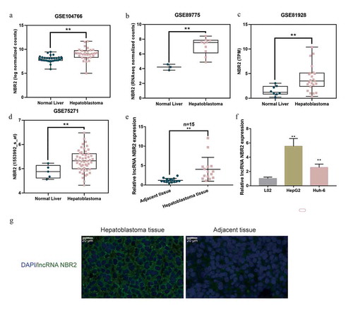 Figure 1. Expression of lncRNA NBR2 according to bioinformatics and experimental analyses (a) The expression of lncRNA NBR2 in adjacent non-cancerous tissues (n = 30) and hepatoblastoma tissues (n = 30) was analyzed using Wilcox analysis according to GSE104766. (b) The expression of lncRNA NBR2 in normal liver tissues (n = 3) and hepatoblastoma tissues (n = 10) was analyzed using unpaired Students’ t-test according to GSE89775. (c) The expression of lncRNA NBR2 in normal liver tissues (n = 8) and hepatoblastoma tissues (n = 23) was analyzed using unpaired Students’ t-test according to GSE81928. (d) The expression of lncRNA NBR2 in normal liver tissues (n = 5) and hepatoblastoma tissues (n = 50) was analyzed using unpaired Students’ t-test according to GSE75271. (e) The expression of lncRNA NBR2 was determined in 15 pairs of adjacent non-cancerous tissues and hepatoblastoma tissues by real-time qPCR and analyzed using paired Students’ t-test(f) The expression of lncRNA NBR2 was determined in L02, HepG2, and Huh-6 cells by real-time PCR and analyzed using one-way ANOVA following Turkey’s test. *P < 0.05, **P < 0.01. (g) The Fish analysis was performed on hepatoblastoma and noncancerous tissue samples to investigate the subcellular localization of lncRNA NBR2