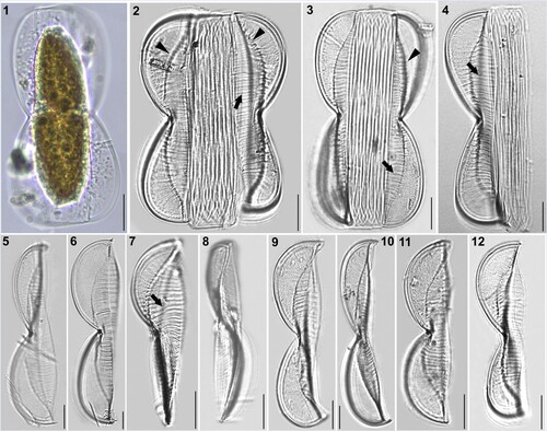 Figures 1–12. LM micrographs of Entomoneis grisslehamnensis sp. nov. at different focal planes. Fig. 1. Live cell in girdle view showing panduriform frustule and plate-like plastid. Figs 2–4. Panduriform frustule with elevated virgae on valve body (arrows), basal fibulae forming arcuate transition between bulged valve body and flattened wing (arrowheads) and numerous crossed girdle bands. Figs 5–6. Valves in girdle view showing scalpelliform apices. Figs 7–8. Apically torsioned valves. Figs 9–12. Valves in girdle view with pronounces raphe fibulae and elevated virgae on valve body. Scale bar = 10 µm.