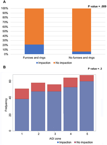 Figure 3 Esophageal food impaction outcome. (A) Percentage of food impactions based on the presence of classic eosinophilic esophagitis endoscopic findings. (B) Frequency of food impaction based on socioeconomic status.