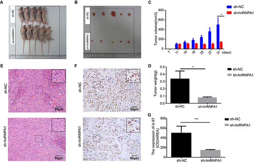 Figure 4 Knockdown hnRNPA1 leads to a significant inhibition effect on tumorigenesis in vivo. (A and B). Gross appearance of xenograft tumors after subcutaneous injections with sh-NC and sh-hnRNPA1 group (n = 5). (C and D). Tumor volumes (C) and weights (D) of the sh-NC groups and sh-hnRNPA1 group (n = 5). (E and F) Representative images of HE (E) and IHC for Ki-67 (F), scale bar = 50 μm. (G) Histogram analysis revealed that hnRNPA1 was associated with Ki-67 expression (n = 5). Data are expressed as the means ± SD. *P < 0.05 and ***P < 0.001.