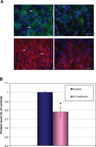 Figure 3 Reduction of MAGP-1 and FBN-1 levels after UV irradiation in dermal fibroblast culture.