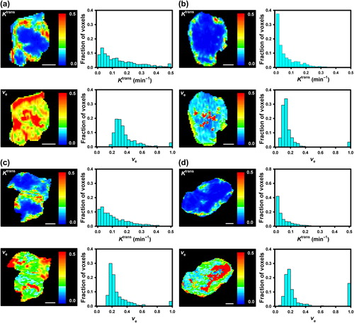 Figure 2. The Ktrans image, Ktrans frequency distribution, ve image, and ve frequency distribution of a non-metastatic ck-160 tumor (a), a metastatic ck-160 tumor (b), a non-metastatic v-27 tumor (c), and a metastatic v-27 tumor (d). Voxels in necrotic tissue have not been excluded from the images and frequency distributions. White scale bars: 3.0 mm.